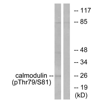 Western Blot - Anti-Calmodulin (phospho Thr79+Ser81) Antibody (A0829) - Antibodies.com