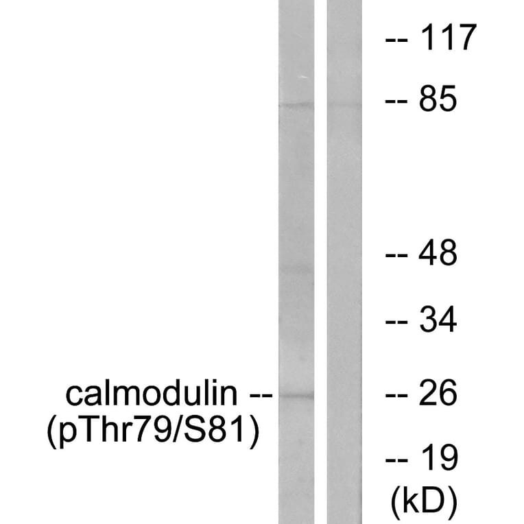 Western Blot - Anti-Calmodulin (phospho Thr79+Ser81) Antibody (A0829) - Antibodies.com