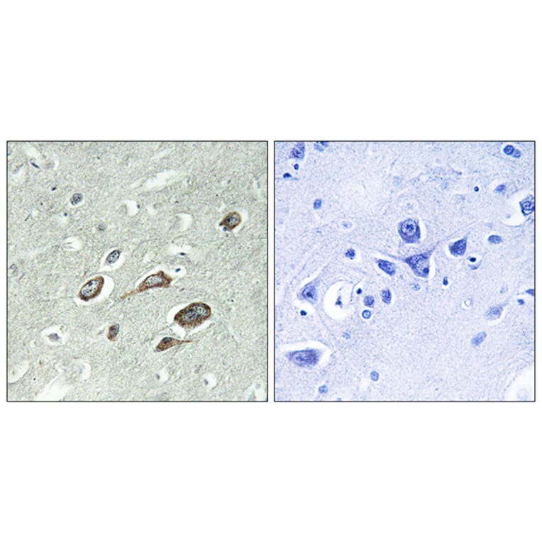 Immunohistochemistry - Anti-Calmodulin (phospho Thr79+Ser81) Antibody (A0829) - Antibodies.com