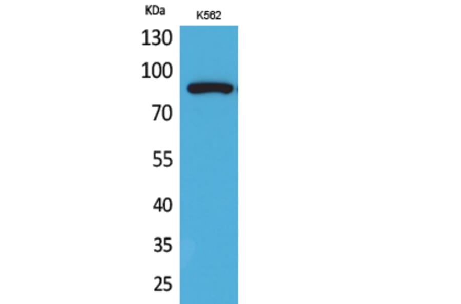 Western Blot - Anti-HSP90A + HSP90AB (acetyl Lys292 + Lys284) Antibody (D12131) - Antibodies.com