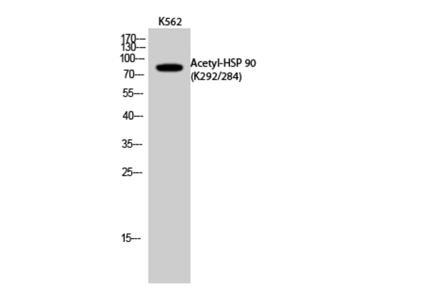 Western Blot - Anti-HSP90A + HSP90AB (acetyl Lys292 + Lys284) Antibody (D12131) - Antibodies.com