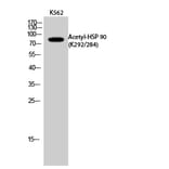 Western Blot - Anti-HSP90A + HSP90AB (acetyl Lys292 + Lys284) Antibody (D12131) - Antibodies.com