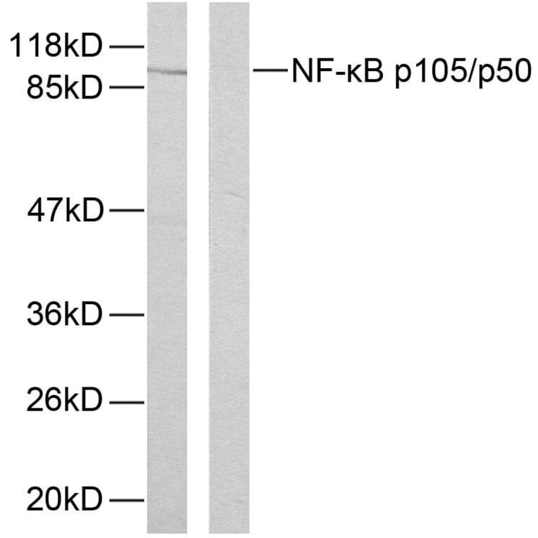 Western Blot - Anti-NF kappa B p105 / p50 (phospho Ser893) Antibody (A7167) - Antibodies.com