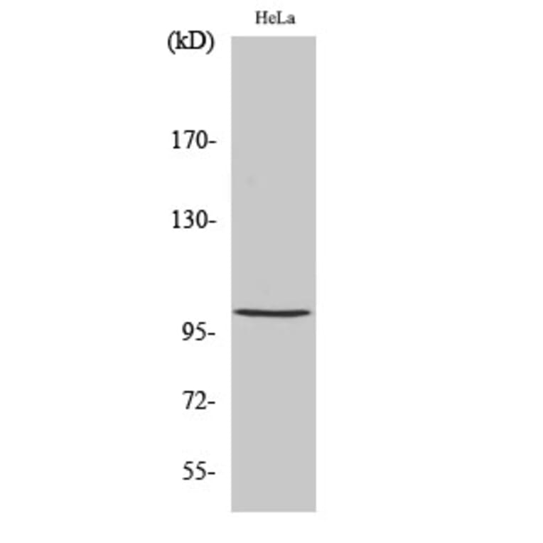 Western Blot - Anti-NF kappa B p105 / p50 (phospho Ser893) Antibody (A7167) - Antibodies.com