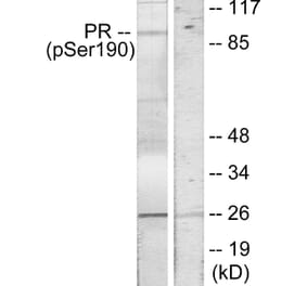 Western Blot - Anti-Progesterone Receptor (phospho Ser190) Antibody (A7200) - Antibodies.com