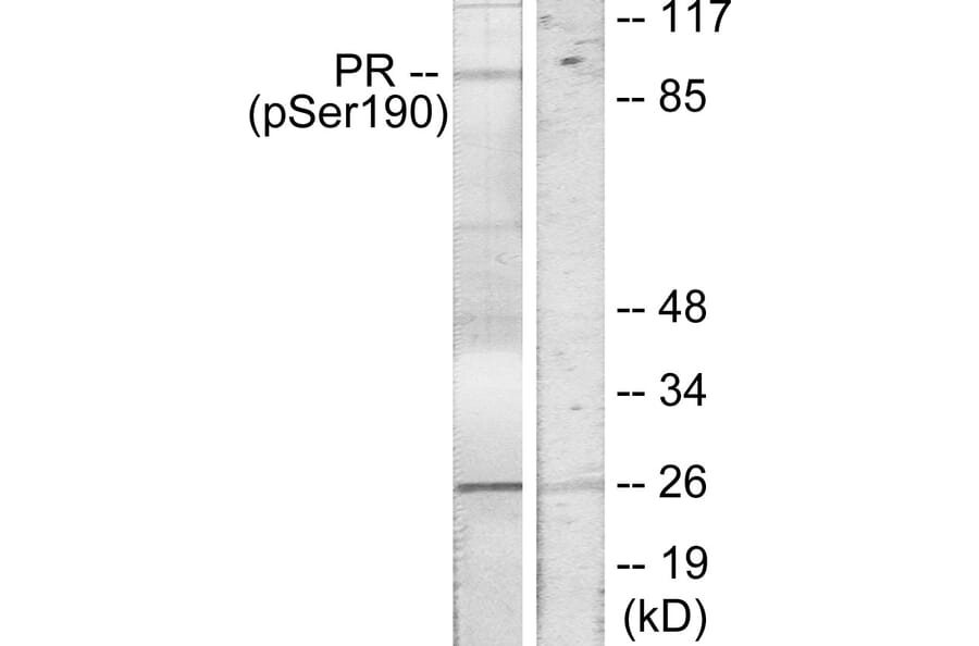 Western Blot - Anti-Progesterone Receptor (phospho Ser190) Antibody (A7200) - Antibodies.com