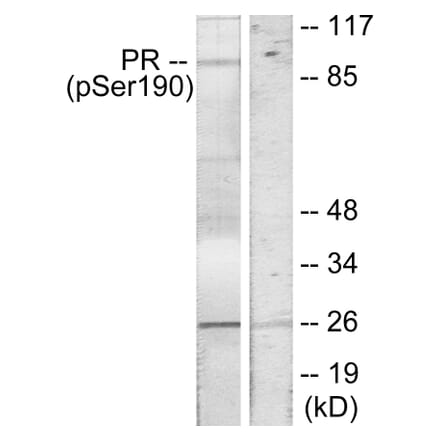 Western Blot - Anti-Progesterone Receptor (phospho Ser190) Antibody (A7200) - Antibodies.com