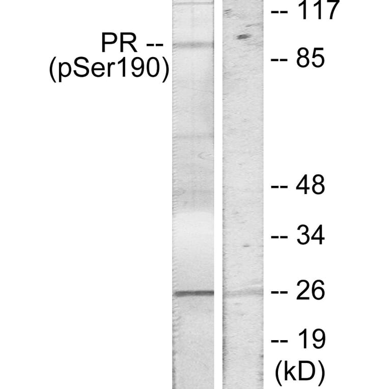 Western Blot - Anti-Progesterone Receptor (phospho Ser190) Antibody (A7200) - Antibodies.com
