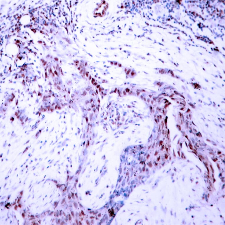 Immunohistochemistry - Anti-Progesterone Receptor (phospho Ser190) Antibody (A7200) - Antibodies.com