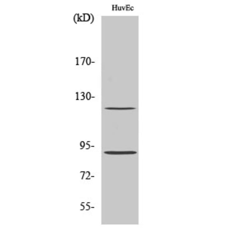 Western Blot - Anti-Progesterone Receptor (phospho Ser190) Antibody (A7200) - Antibodies.com