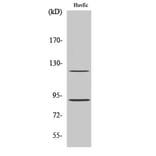 Western Blot - Anti-Progesterone Receptor (phospho Ser190) Antibody (A7200) - Antibodies.com