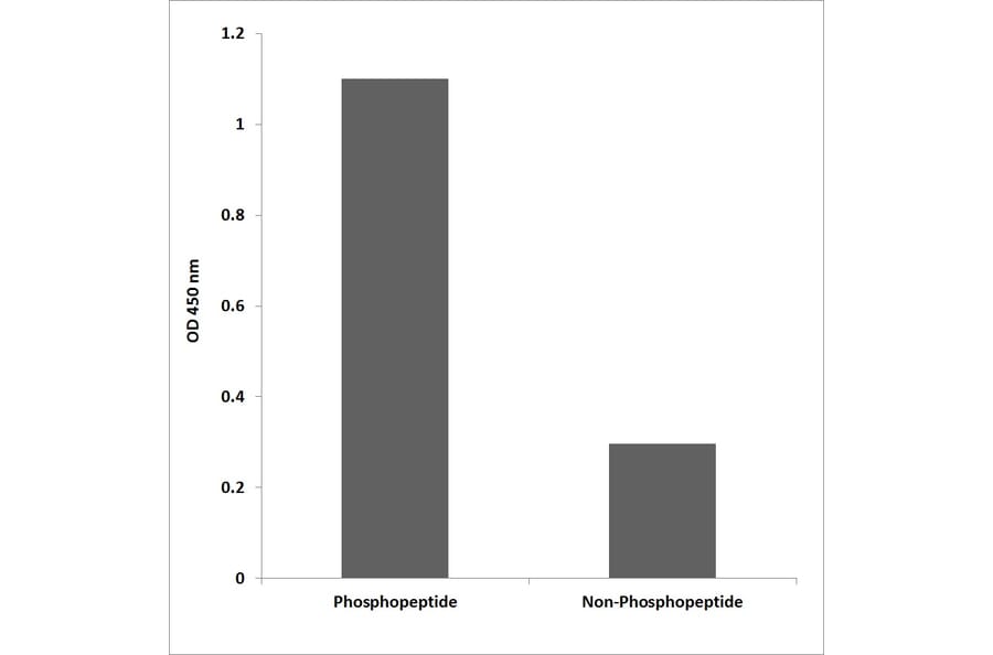 ELISA - Anti-Retinoblastoma (phospho Thr826) Antibody (P12-1170) - Antibodies.com