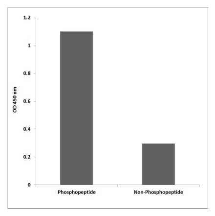 ELISA - Anti-Retinoblastoma (phospho Thr826) Antibody (P12-1170) - Antibodies.com
