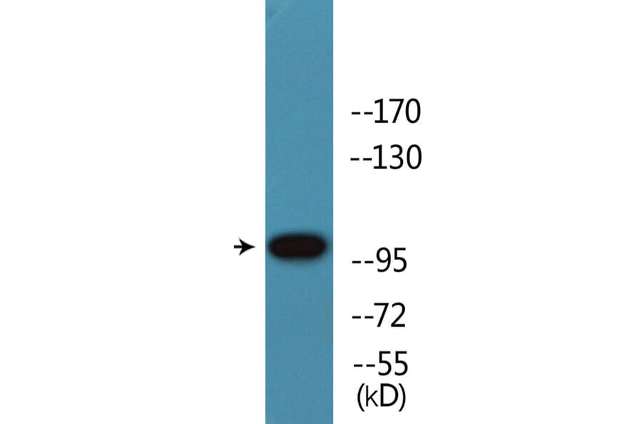 Western Blot - Anti-Retinoblastoma (phospho Thr826) Antibody (P12-1170) - Antibodies.com