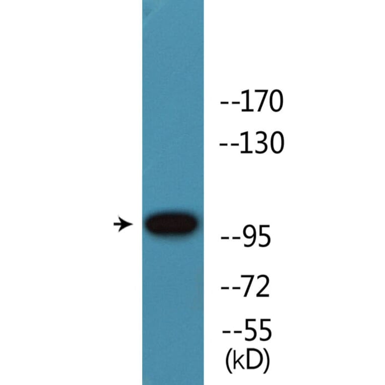 Western Blot - Anti-Retinoblastoma (phospho Thr826) Antibody (P12-1170) - Antibodies.com