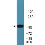 Western Blot - Anti-Retinoblastoma (phospho Thr826) Antibody (P12-1170) - Antibodies.com