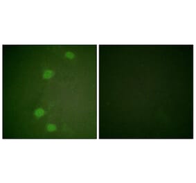 Immunofluorescence - Anti-Retinoblastoma (phospho Ser249) Antibody (A0982) - Antibodies.com