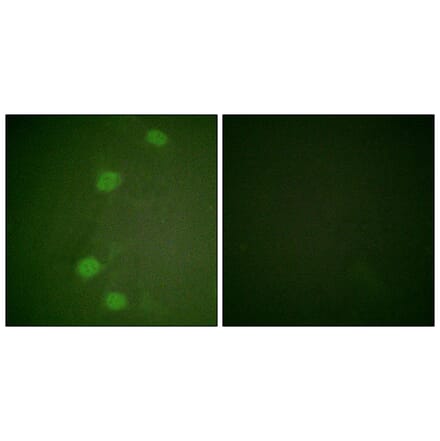 Immunofluorescence - Anti-Retinoblastoma (phospho Ser249) Antibody (A0982) - Antibodies.com