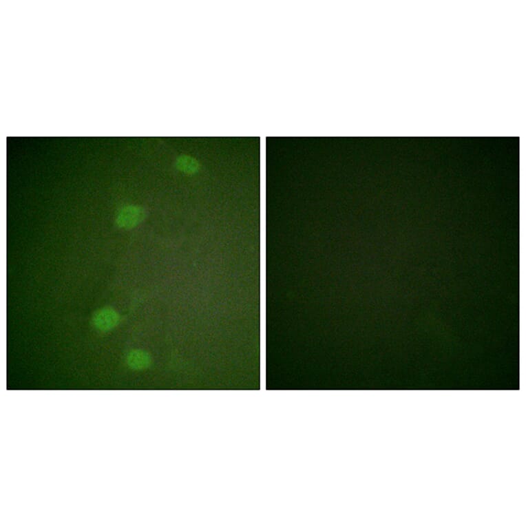 Immunofluorescence - Anti-Retinoblastoma (phospho Ser249) Antibody (A0982) - Antibodies.com