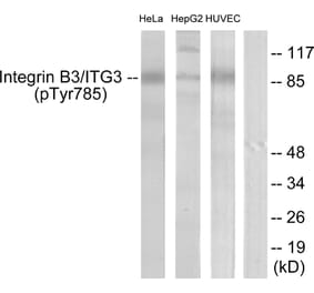 Western Blot - Anti-Integrin beta3 (phospho Tyr785) Antibody (A7119) - Antibodies.com