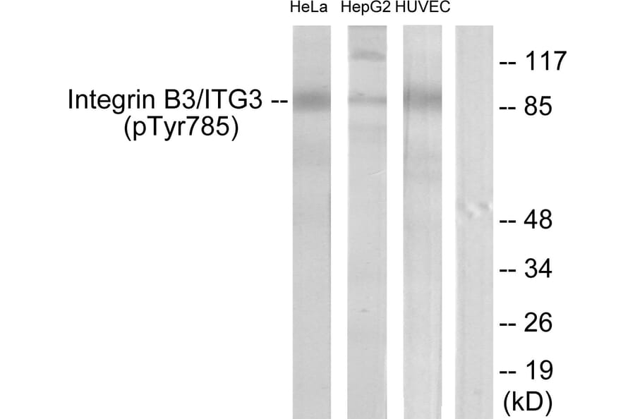 Western Blot - Anti-Integrin beta3 (phospho Tyr785) Antibody (A7119) - Antibodies.com