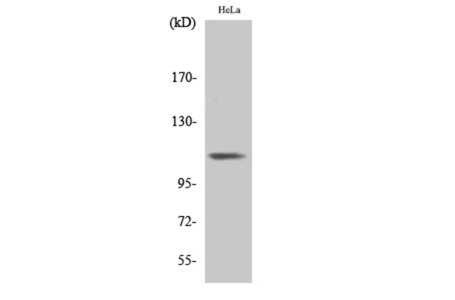 Western Blot - Anti-Integrin beta3 (phospho Tyr785) Antibody (A7119) - Antibodies.com