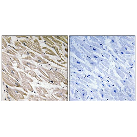 Immunohistochemistry - Anti-PPP1R2 (phospho Ser120+Ser121) Antibody (A1115) - Antibodies.com