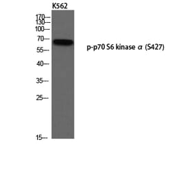 Western Blot - Anti-p70 S6 Kinase (phospho Ser427) Antibody (A8156) - Antibodies.com