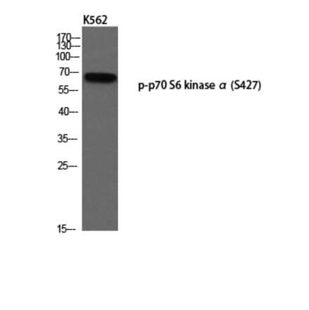Western Blot - Anti-p70 S6 Kinase (phospho Ser427) Antibody (A8156) - Antibodies.com