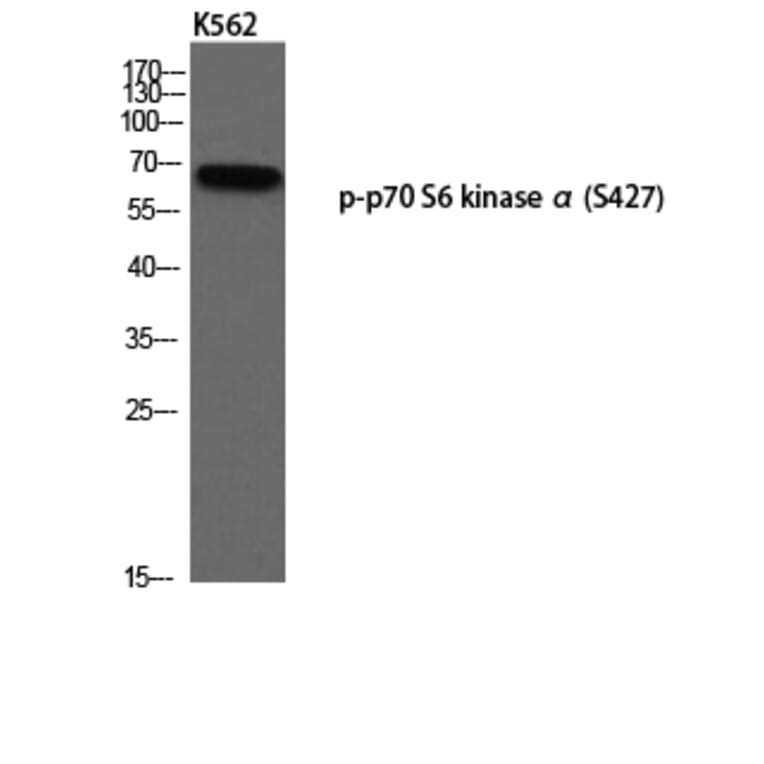 Western Blot - Anti-p70 S6 Kinase (phospho Ser427) Antibody (A8156) - Antibodies.com