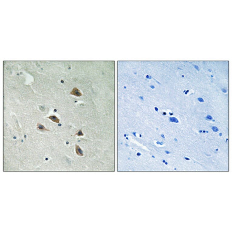 Immunohistochemistry - Anti-p70 S6 Kinase (phospho Ser427) Antibody (A8156) - Antibodies.com