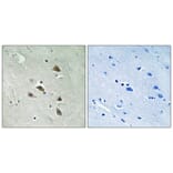 Immunohistochemistry - Anti-p70 S6 Kinase (phospho Ser427) Antibody (A8156) - Antibodies.com