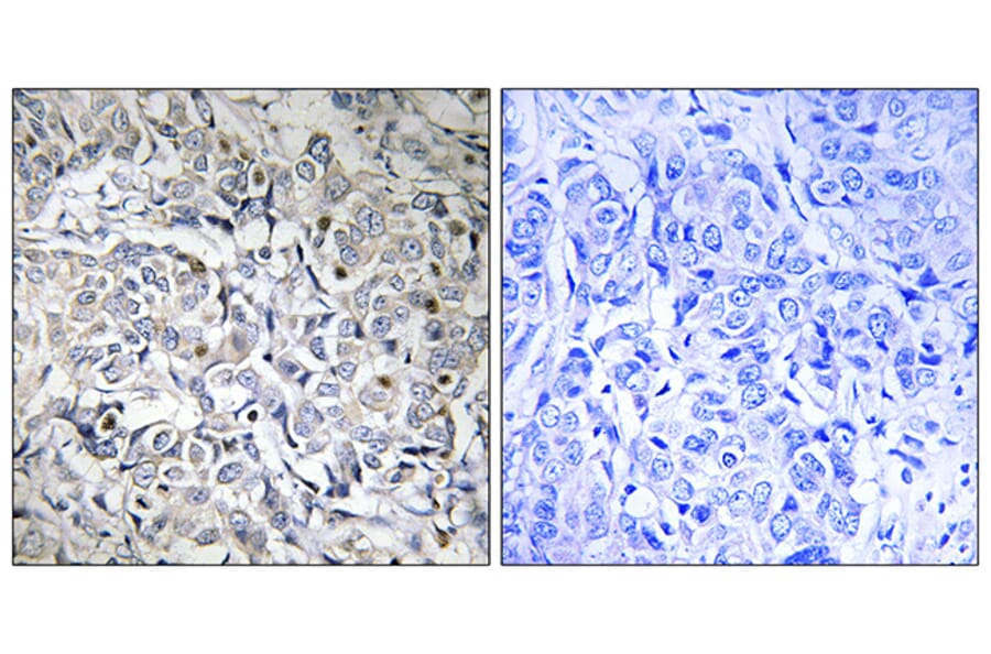 Immunohistochemistry - Anti-NF-kappaB p65 (phospho Thr505) Antibody (A0525) - Antibodies.com