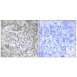 Immunohistochemistry - Anti-NF-kappaB p65 (phospho Thr505) Antibody (A0525) - Antibodies.com