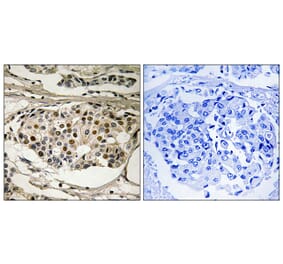 Immunohistochemistry - Anti-NF-kappaB p65 (phospho Ser281) Antibody (A8049) - Antibodies.com