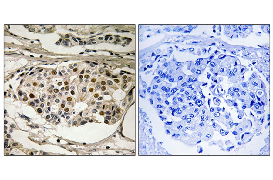 Immunohistochemistry - Anti-NF-kappaB p65 (phospho Ser281) Antibody (A8049) - Antibodies.com