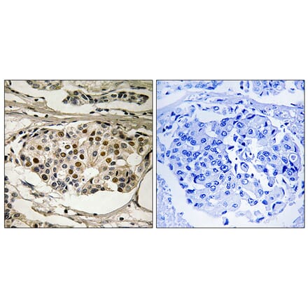 Immunohistochemistry - Anti-NF-kappaB p65 (phospho Ser281) Antibody (A8049) - Antibodies.com