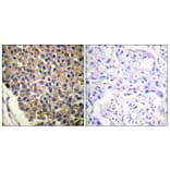 Immunohistochemistry - Anti-IL-8R beta (phospho Ser347) Antibody (A1066) - Antibodies.com