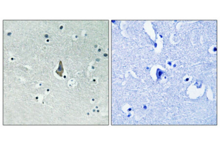 Immunohistochemistry - Anti-IL-8R beta (phospho Ser347) Antibody (A1066) - Antibodies.com