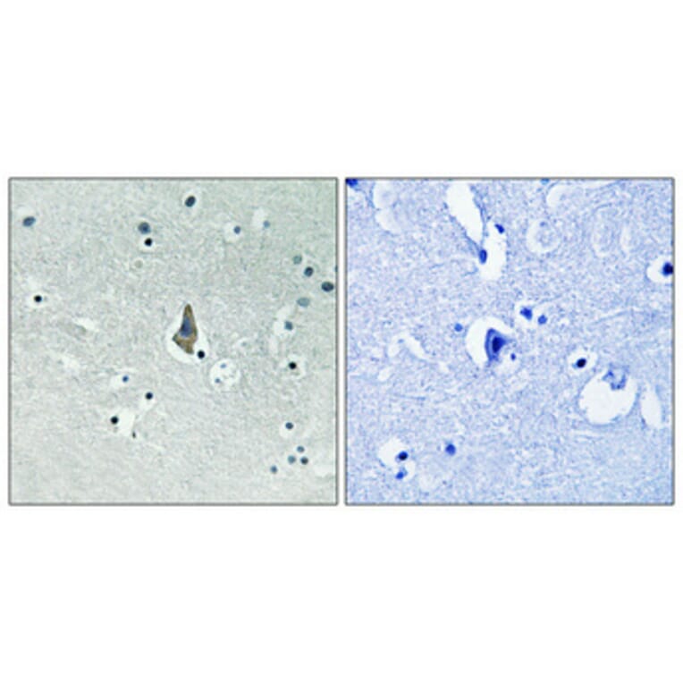 Immunohistochemistry - Anti-IL-8R beta (phospho Ser347) Antibody (A1066) - Antibodies.com