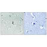 Immunohistochemistry - Anti-IL-8R beta (phospho Ser347) Antibody (A1066) - Antibodies.com