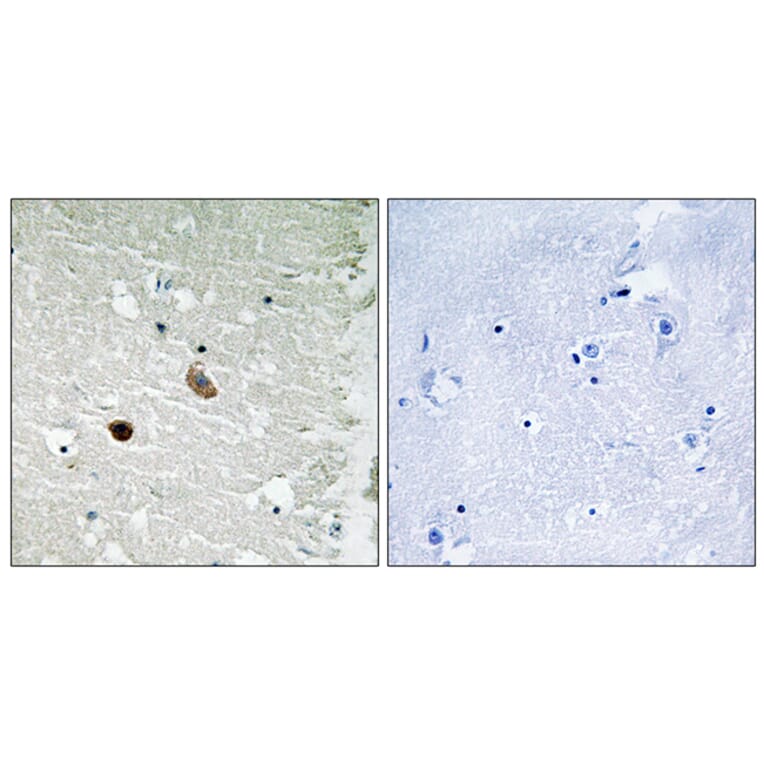 Immunohistochemistry - Anti-CaMK2 beta + gamma + delta Antibody (B8085) - Antibodies.com