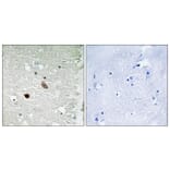 Immunohistochemistry - Anti-CaMK2 beta + gamma + delta Antibody (B8085) - Antibodies.com