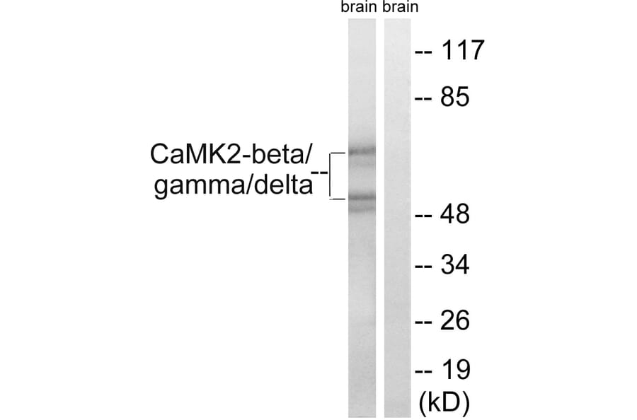 Western Blot - Anti-CaMK2 beta + gamma + delta Antibody (B8085) - Antibodies.com
