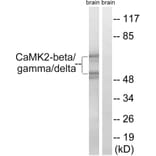 Western Blot - Anti-CaMK2 beta + gamma + delta Antibody (B8085) - Antibodies.com