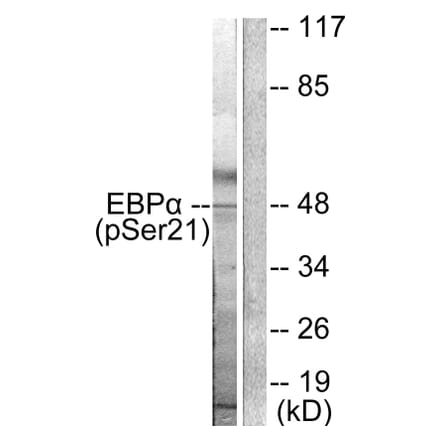 Western Blot - Anti-CEBP alpha (phospho Ser21) Antibody (A0056) - Antibodies.com