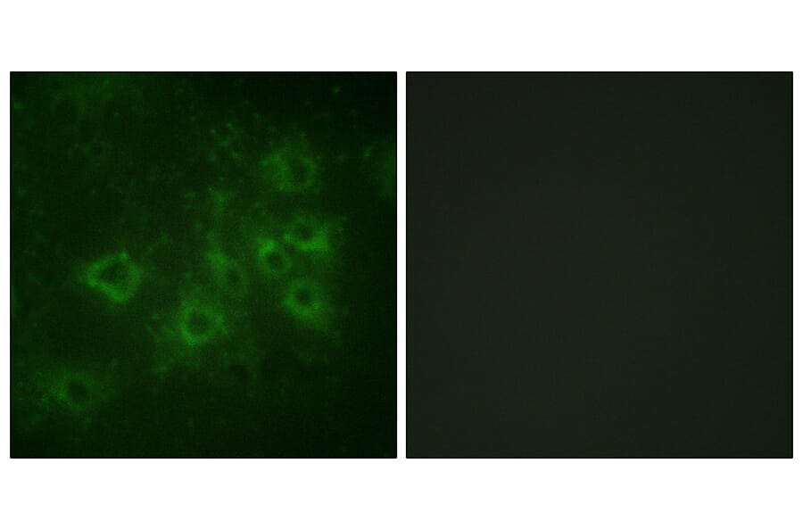 Immunofluorescence - Anti-Synapsin1 (phospho Ser605) Antibody (A1009) - Antibodies.com