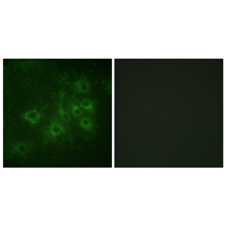 Immunofluorescence - Anti-Synapsin1 (phospho Ser605) Antibody (A1009) - Antibodies.com