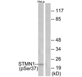 Western Blot - Anti-Stathmin 1 (phospho Ser37) Antibody (A7232) - Antibodies.com