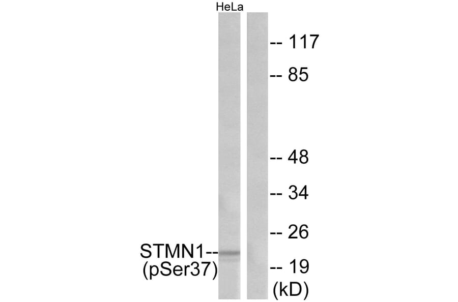 Western Blot - Anti-Stathmin 1 (phospho Ser37) Antibody (A7232) - Antibodies.com